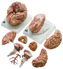 BS 23 Gehirn mit Arterien