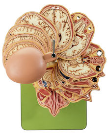 BS 5/5 Anatom. Schnittmodell des Kopfes + CT-/MR-Aufnahmen