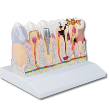 Dentalmodell, 4-fache Größe – EZ Augmented Anatomy