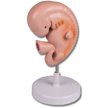 Menschlicher Embryo, 4 Wochen