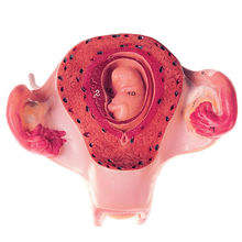 MS 12/2 Uterus mit Embryo im 2. Monat