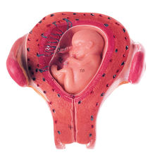 MS 12/3 Uterus mit Embryo im 3. Monat