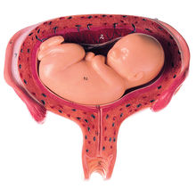 MS 12/5 Uterus mit Fetus im 5. Monat