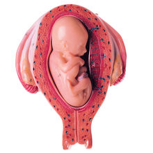 MS 12/6 Uterus mit Fetus im 5. Monat
