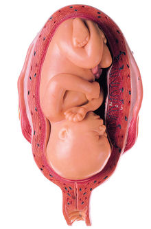 MS 12/7 Uterus mit Fetus im 7. Monat